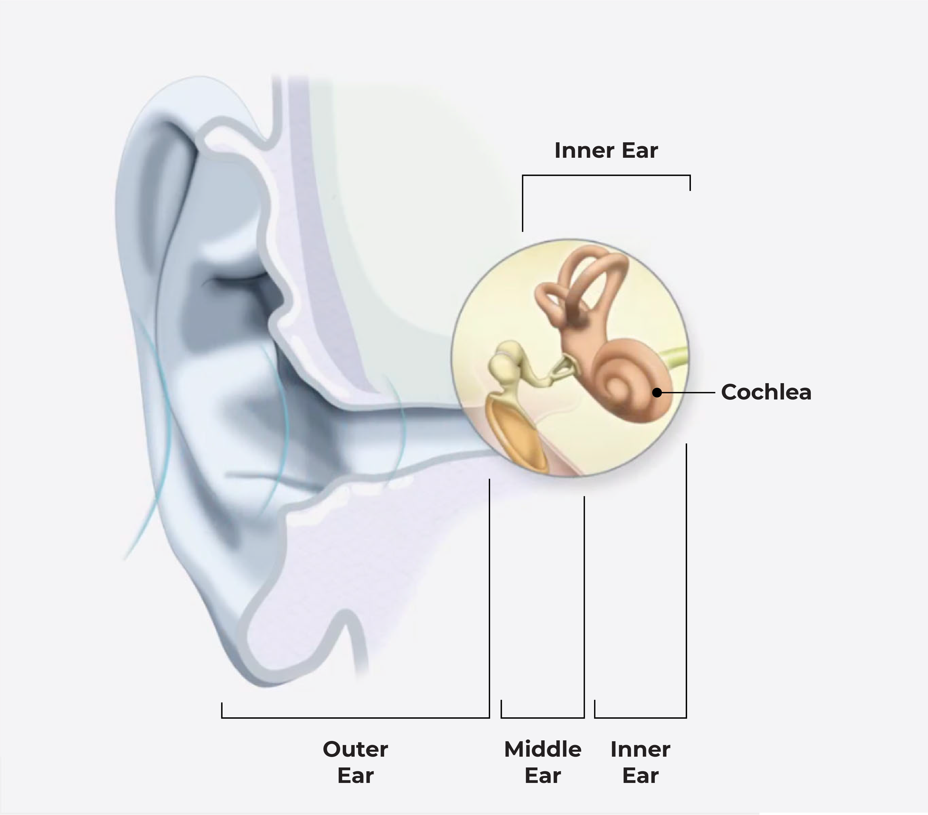 Hearing Loss Hearing Alternatives Envoy Medical